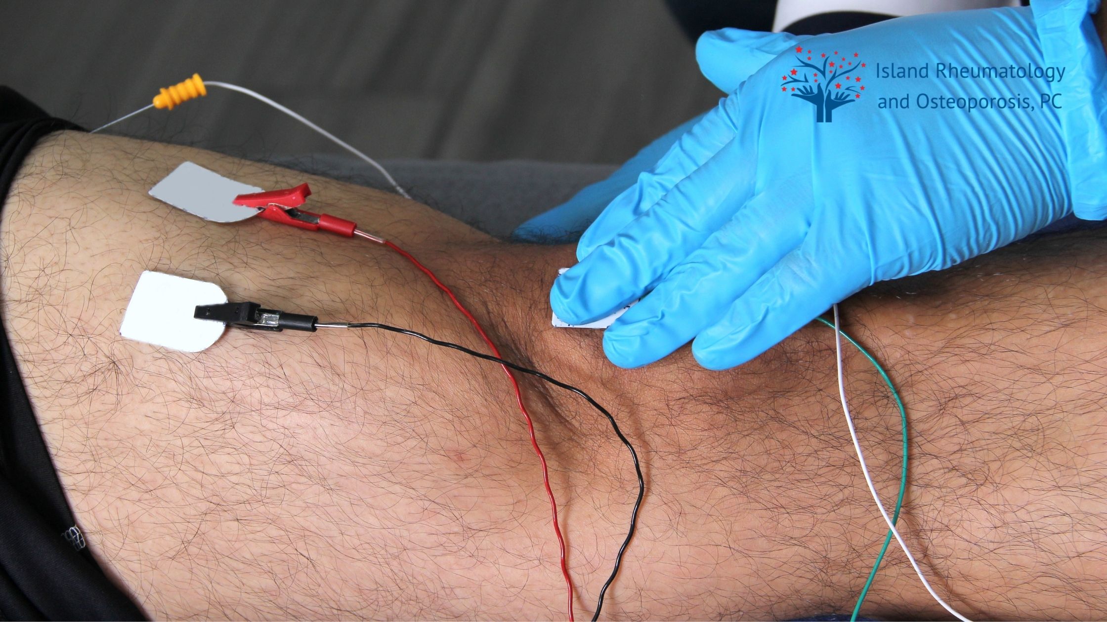 A gloved hand places electrodes on a person's knee, likely preparing for an electrotherapy or diagnostic procedure.